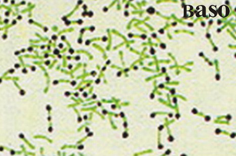 ��Ⱦ�w��ȾɫҺ