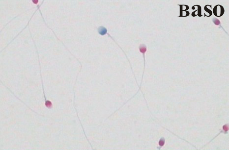 ���Ӻ˵���Ⱦɫԇ���У������{(l��n)����